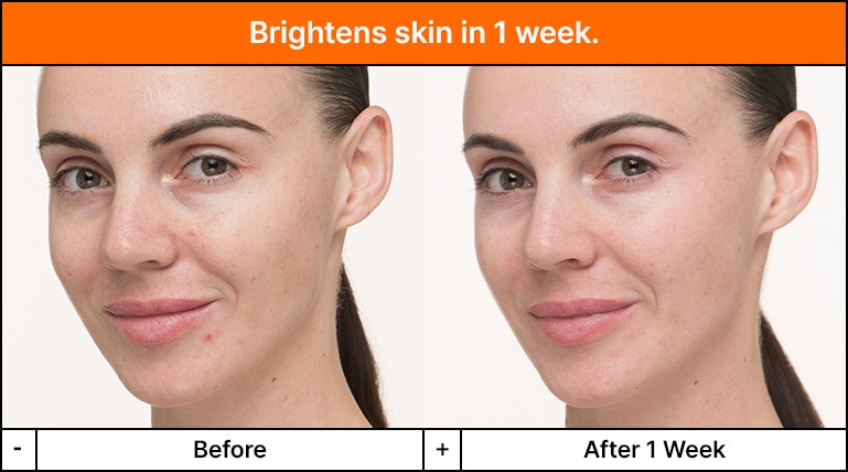 Before and after results reveal brighter looking skin and reduced fine lines in the eye area.
