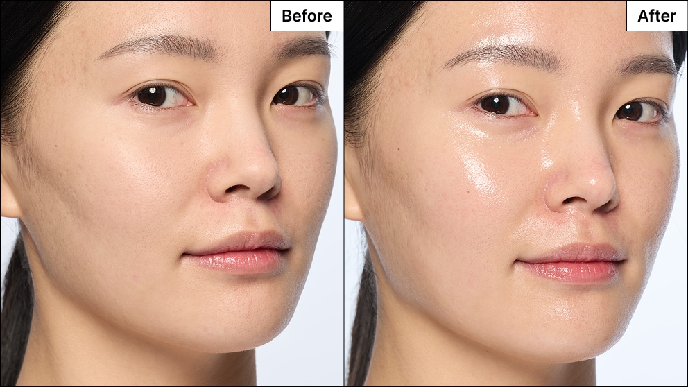 Model with acne reveals a refreshed face with reduced redness and coverage from her blemish marks.