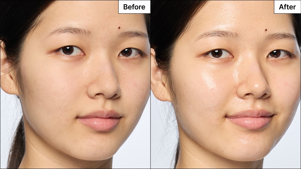Model with acne reveals a refreshed face with reduced redness and coverage from her blemish marks.