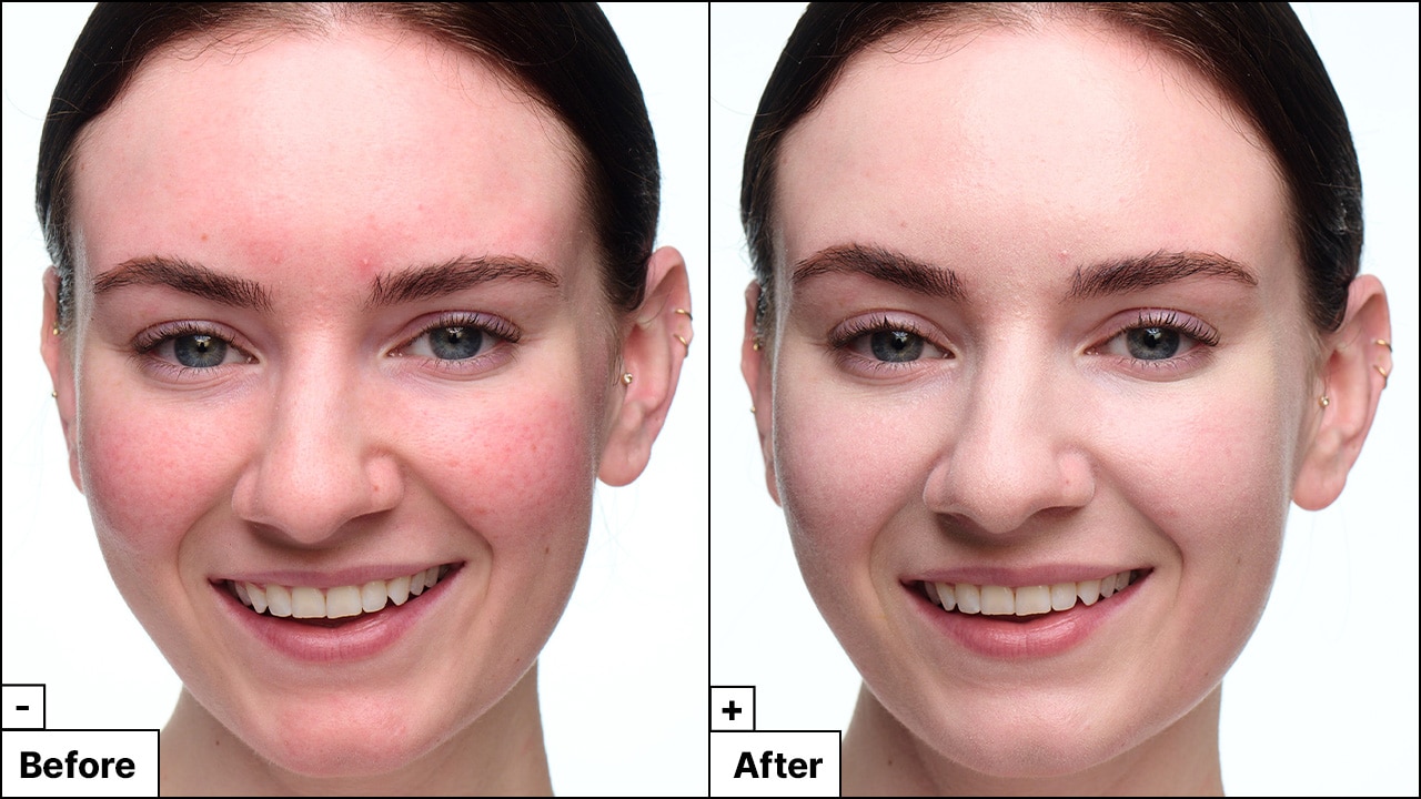 Model with red blemishes reveals a refreshed face with reduced redness and coverage from her blemish marks.