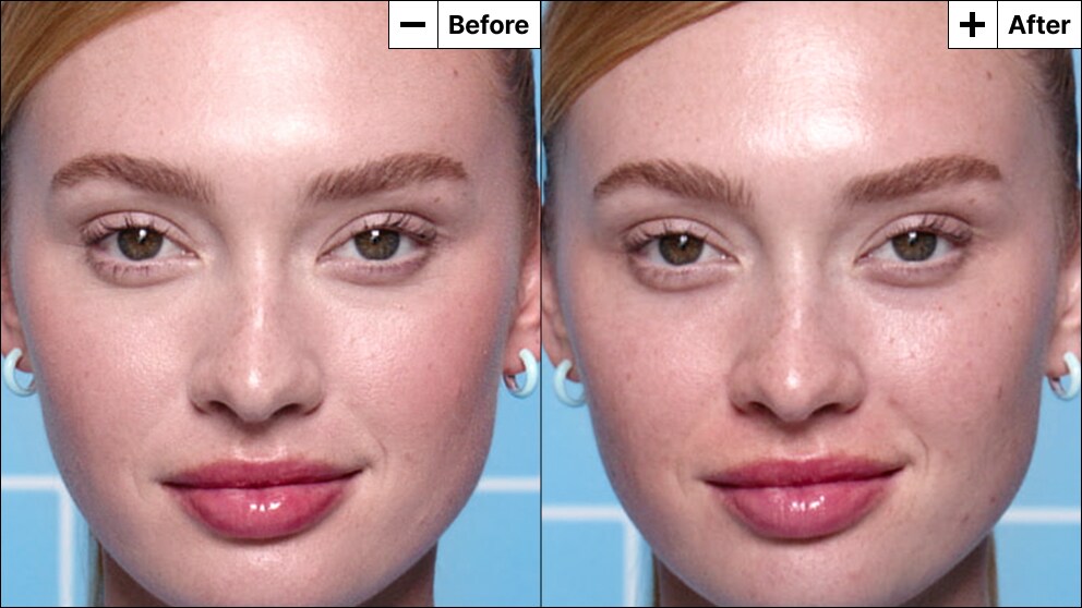 Model with acne reveals a refreshed face with reduced redness and coverage from her blemish marks.