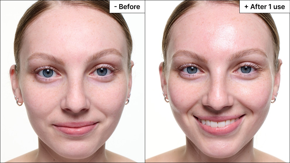 Model with acne reveals a refreshed face with reduced redness and coverage from her blemish marks.