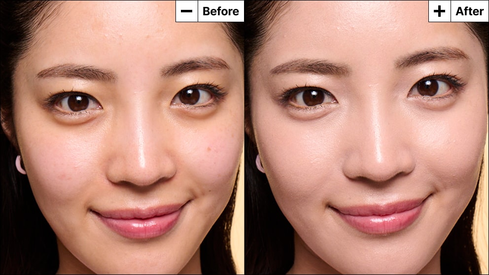 Model with acne reveals a refreshed face with reduced redness and coverage from her blemish marks.