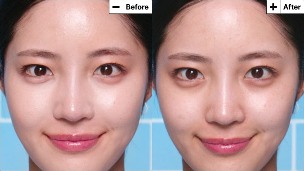 Model with acne reveals a refreshed face with reduced redness and coverage from her blemish marks.