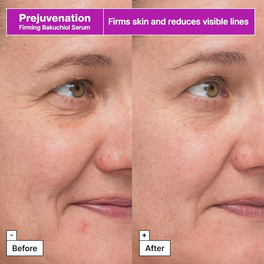 Prejuvenation with Bakuchiol Anti- Aging Value Set for Fine Lines
