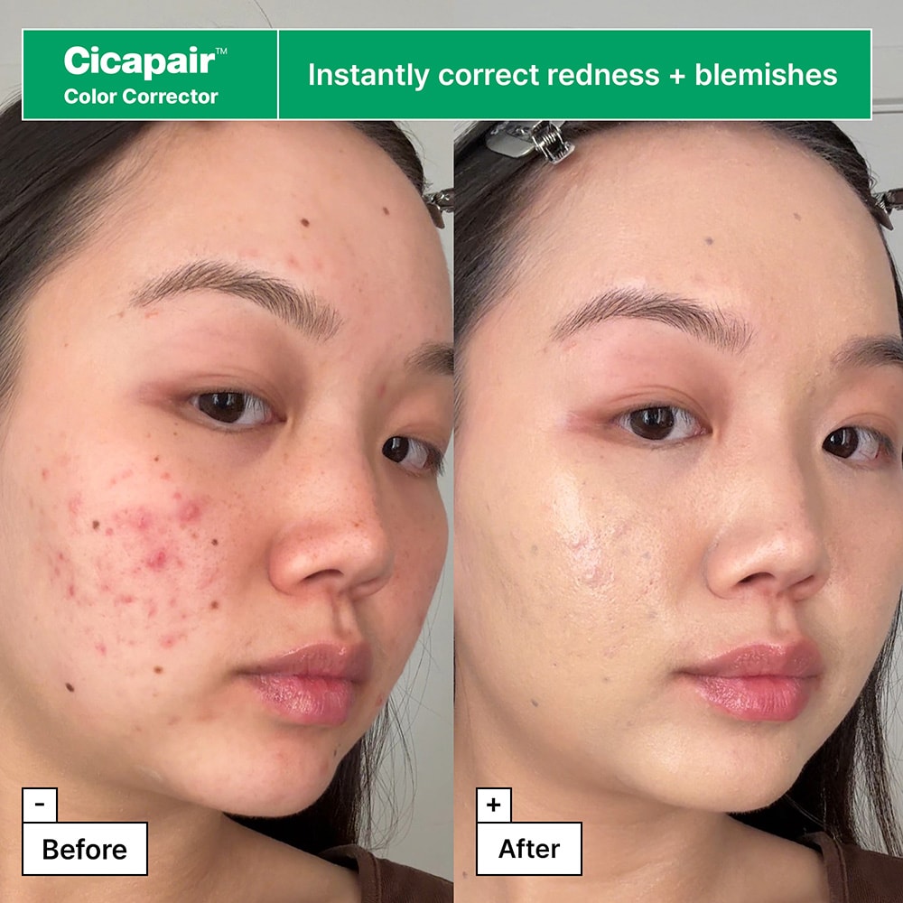 Cicapair™ Redness Reducing Value Set​ | Dr.Jart+ Skincare