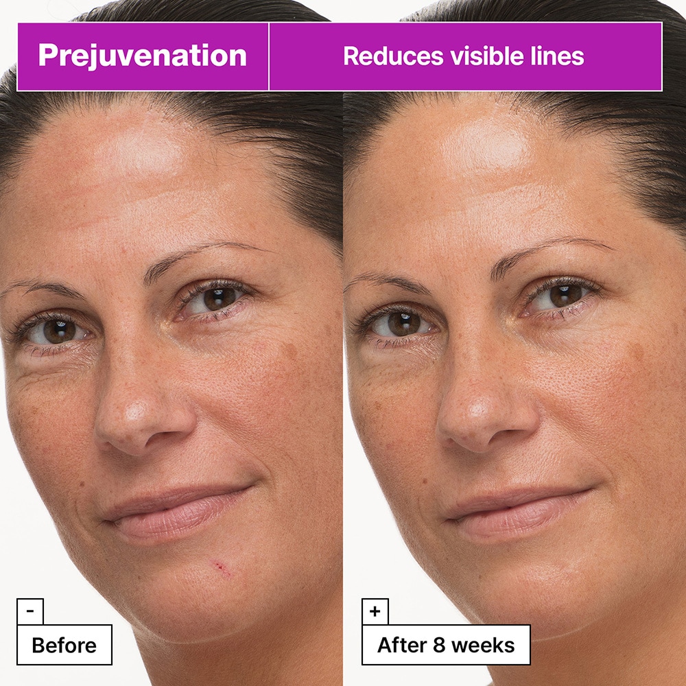 Prejuvenation Firming Bakuchiol Korean Face Cream Moisturizer for